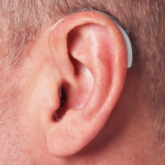 Hearing Aid